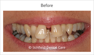 Patient case 5 before
