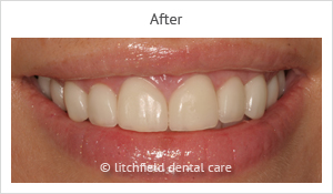 Patient case 2 after