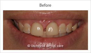 Patient case 2 before
