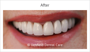 Patient case 1 after