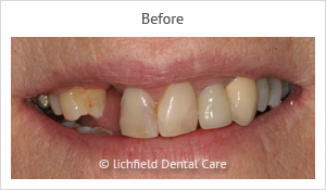 Patient case 1 before