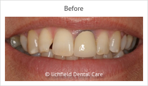 Patient case 4 before