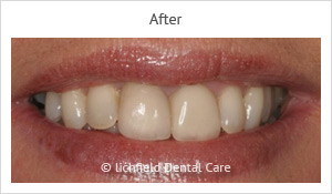 Patient case 3 after