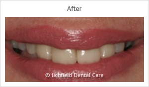 Patient case 6 after