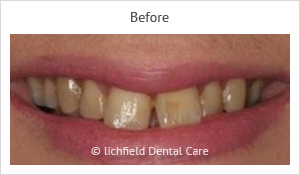 Patient case 6 before