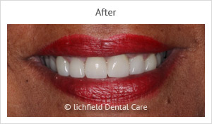 Patient case 7 after