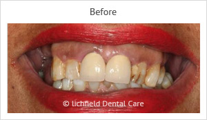 Patient case 7 before