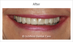 Patient case 8 after