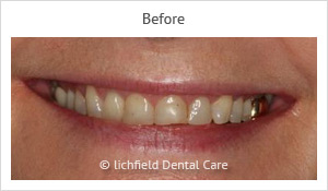 Patient case 8 before