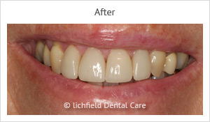 Patient case 9 after