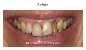 Patient case 9 before