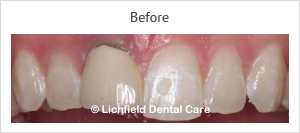 Patient case 7 before