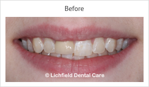 Patient case 8 before