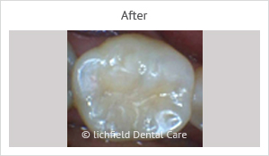 Patient case 2 after