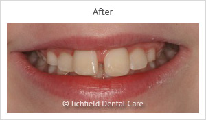 Patient case 4 after