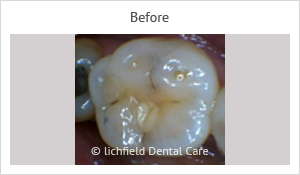 Patient case 2 before