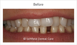 Patient case 1 before
