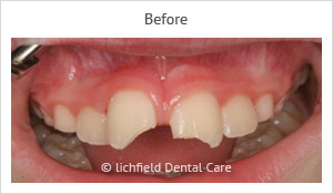 Patient case 4 before