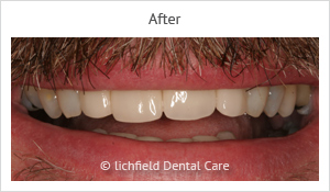 Patient case 2 after