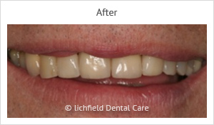 Patient case 3 after