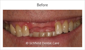 Patient case 3 before
