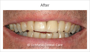 Patient case 4 after