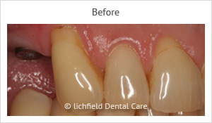 Patient case 5 before