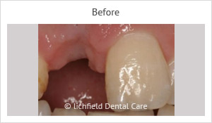 Patient case 6 before