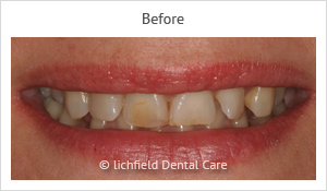 Patient case 1 before