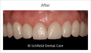 Patient case 2 after