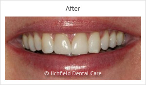 Patient case 3 after