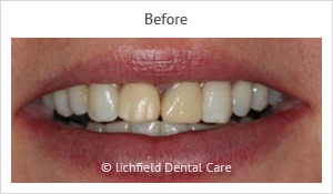 Patient case 3 before
