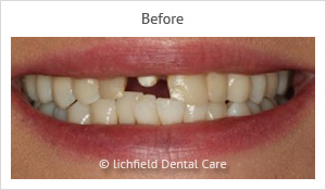 Patient case 4 before