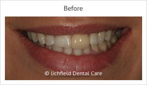 Patient case 5 before