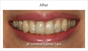 Patient case 6 after