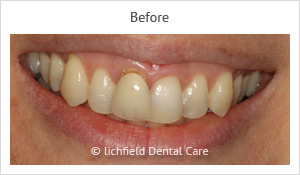 Patient case 6 before